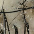 르칼피아 이미지