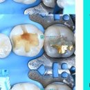 튼튼이치과의원 이미지