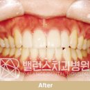 우리치아 치과기공소 이미지