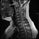 원주프라임병원 이미지
