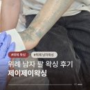 제이제이인테리어 - 기장군 명례산단3로 13-60 | 위례 남자왁싱 후기 제이제이왁싱 팔 왁싱으로 여름 준비 끝