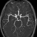 초음파, CT ,MRI .MRA 용도 설명과 비교 이미지