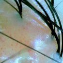 숲칼프성북교육센터 | 길음동 두피뾰루지 탈모고민, 내돈내산 숲칼프 성북교육센터 두피케어 후기