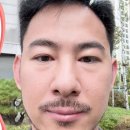 30대 남자도 부담없이 수술하는, 무드온 눈밑지 브이로그📺 (눈밑지방재배치+미세지방이식)