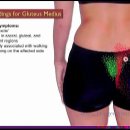 대둔근 압통점 (The Gluteus Medius Trigger Points and Low Back Pain) 이미지