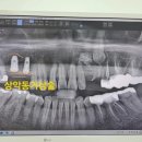 제우스치과의원 네이버블로그