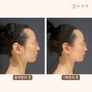 마곡 윤곽관리전문 추천 마곡경락 오브미에스테틱 주차 가격 정보 후기