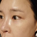 기린의원 | 강남 줄기세포 주사 속부터 달라지는 확실한 케어
