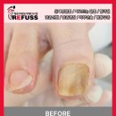 레푸스인천부평씨지브이(CGV)점 | 부평역 발톱무좀 더이상 방치하시지 마세요 "레푸스부평CGV점"