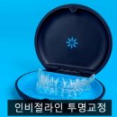 인비절라인 가격이 부담스럽다면? 치과 숙련도와 '가치'를 먼저 따져보세요
