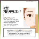 더이노써클