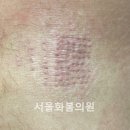 서울화봄의원 이미지