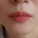 위드유 파트너스 | [광고]입술필러 6개월 후기 | 만족하면서도 후회되는 이유 (feat.입술필러 멍크림)