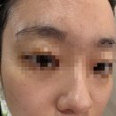 대구에스테틱 신매피부관리 잘 하는 곳 리주비 스킨앤왁싱 피부관리받은 후기