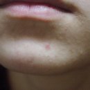 라인메드 이미지