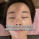 주식회사 라인에너지고양 | 턴업에스테틱 피부관리 고양일산점 에너지테라피 작은얼굴관리 후기
