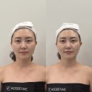 유성메디칼케어 | 대전신부관리 웨딩케어 받은 후기 :: 모든미에스테틱