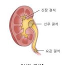 오른쪽 옆구리 통증 병원 오른쪽 옆구리 뒤 통증 원인 이미지