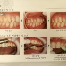 백상치재 이미지