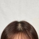 질문으로 톡톡, 글이 팡팡 | 2030 여성 가르마 고민 해결 – 창원두피문신 실제 후기