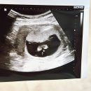 씨유수원더플러스점 | 임신초기 입덧수액 비타민 성분 금액 후기 입덧심할때 달려갔던 수원산부인과 우먼플러스