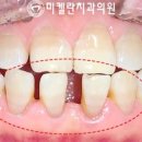 미켈란치과의원 이미지