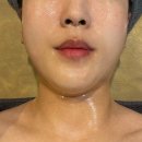 엔쏘에스테틱 이미지