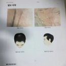 1497 | 파주 운정두피관리 전문점 닥터 모다르 파주점 방문후기