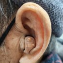 벨톤보청기 김포공항센터 | 벨톤보청기 가격 비교, 인비전 세린 어메이즈