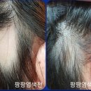 큐사랑염색 이미지