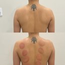 [천안불당]키아라 천안본점:에너지테라피:승모근 천안 신부관리