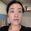 신촌피부관리 라르본뷰티 예비신부관리 찐후기