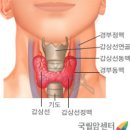 갑상선암 (Thyroid Cancer) 이미지