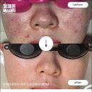 빛채은에스테틱 대구진천점