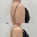 로제토뷰티 | 청라체형교정 로제토뷰티 라운드 숄더 하체 순환 교정 후기