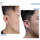 이슈헤어 이미지