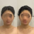 마노아뷰티 - 서구 | [청주 체형관리] 청주신부관리 추천! 마노아뷰티
