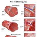 에이앤프리햅 이미지