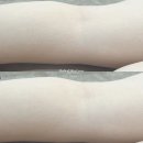 튼살타투 종아리 튼살커버 후기 (사진있음)