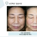 박순영 피부&바디 네이버블로그