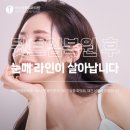 이브성형외과 네이버블로그