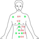 ★사혈침 요법 이미지