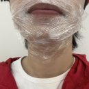 에프앤디넷 영천제이병원점 | 영천 남자 수염 레이저제모, 영천제이병원 청담미 피부과