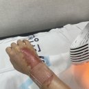한강수성형외과의원 네이버블로그