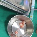 하단부부치과의원 | 인천 구월동 서울이턱사랑니치과의원 하단매복사랑니 발치 후기