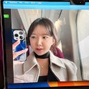 [내돈내산] 논현 버츄 rf 솔직 후기 (시술 후 일상 변화까지!)