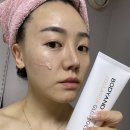 쎄라헤어 - 평택시 | 물방울초음파 고주파마사지기 글로우쎄라 리얼후기