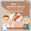 뇌졸중 발병 원인 목에도 있다 ‘경동맥 협착증’ 의심 증상 & 치료‧관리 이미지