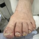 레푸스구미