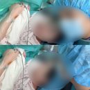 시온안경 | 시온여성병원 제왕절개 수술당일 후기(0일차)